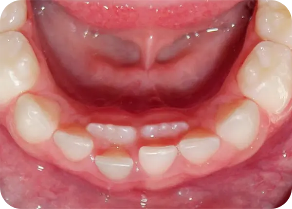 Ortodoncista en Guatemala